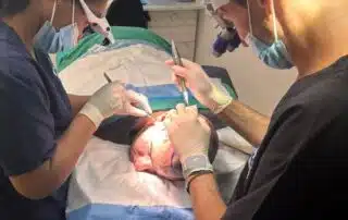 Hair Transplant Surgery Cape Town Dr Jankelowitz
