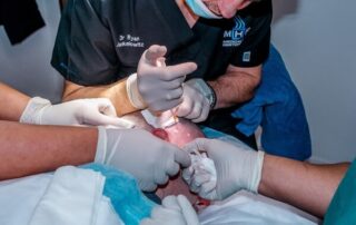 Are hair transplants permanent