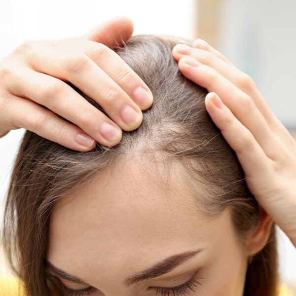 Hair loss hair falling out Hair loss hair falling out