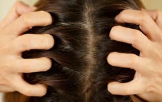 Itching scalp hair growth