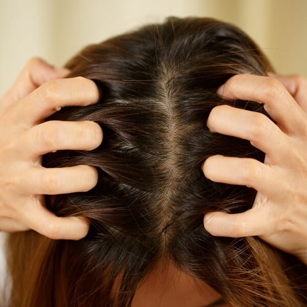 Itching scalp hair growth Itching scalp hair growth