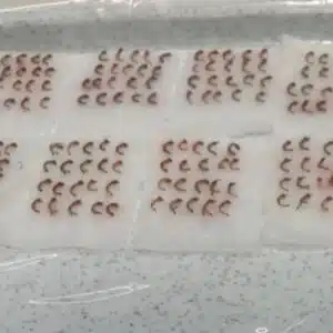 Hair follicles male hair transplant Hair follicles male hair transplant